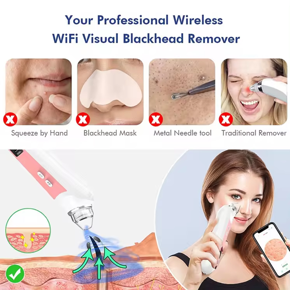6 Heads Pore Cleaner Blackhead - đánh giá và giá Pore Vacuum