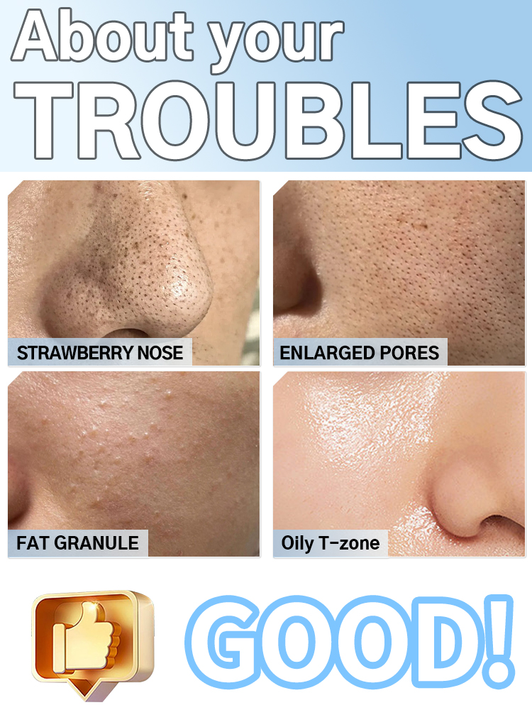 Blackhead Remover Pore Cleaner - đánh giá và giá Pore Vacuum