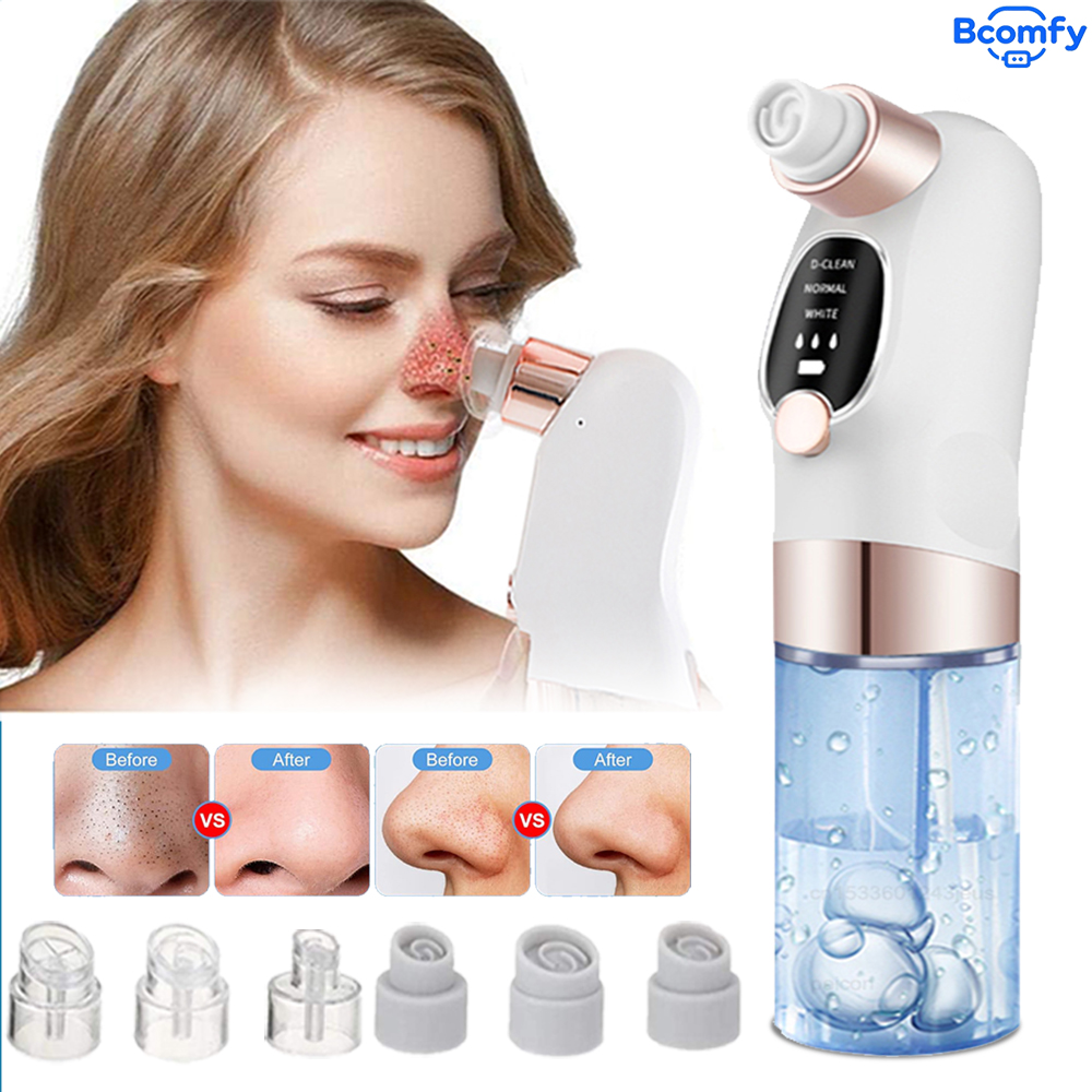 Electric Blackhead Remover Vac - đánh giá và giá Pore Vacuum