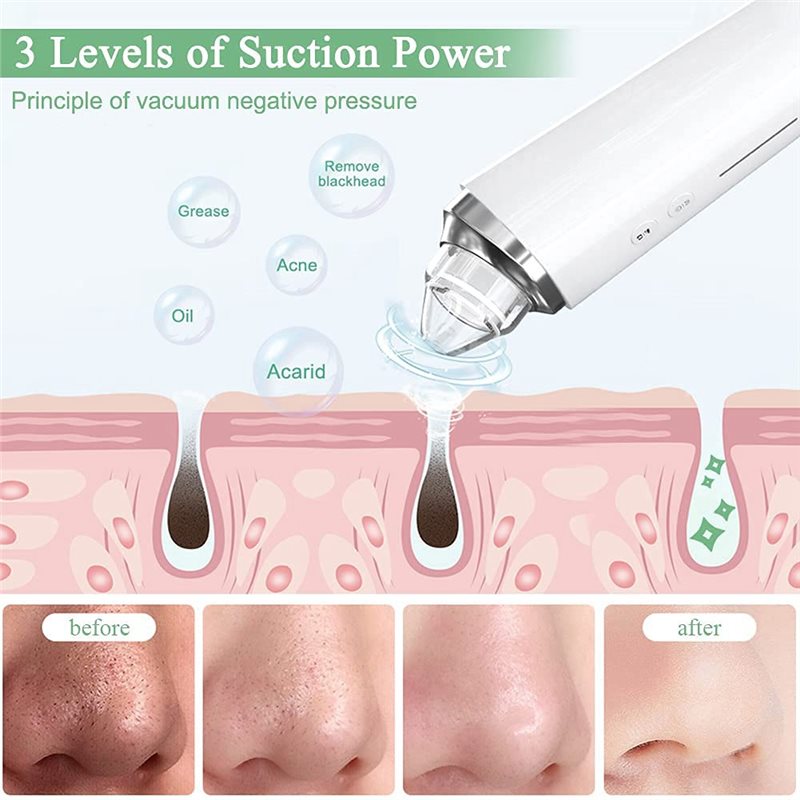 【FITTING】Blackhead Remover Por - đánh giá và giá Pore Vacuum