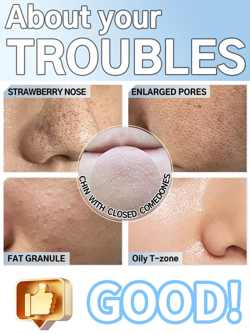 Electric Pore Vacuum Blackhead - đánh giá và giá Pore Vacuum
