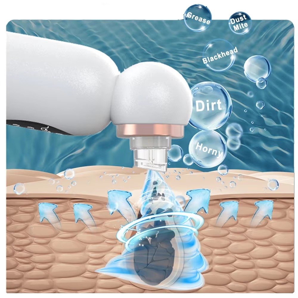 Blackhead Remover Pore Vacuum  - đánh giá và giá Pore Vacuum