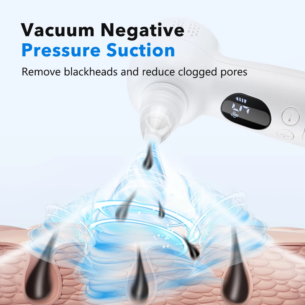 Blackhead Remover Pore Vacuum  - đánh giá và giá Pore Vacuum