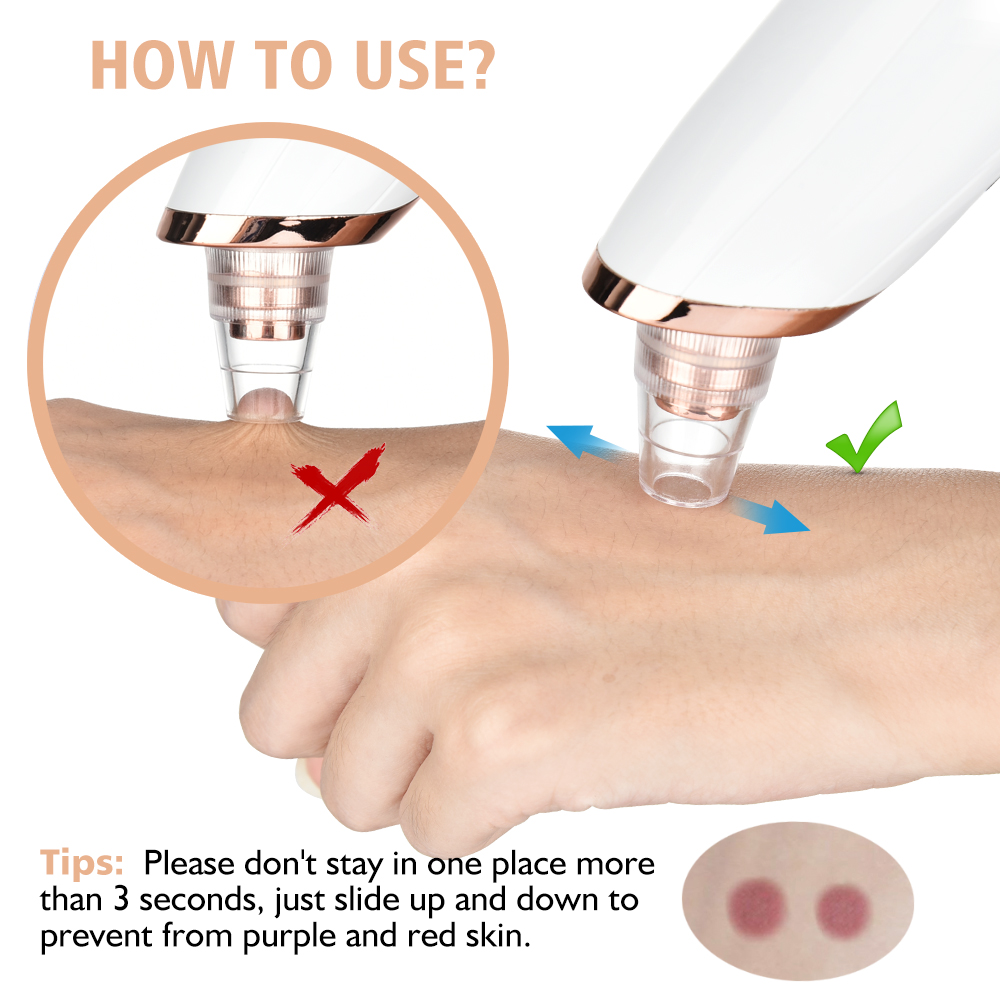 Mụn Đầu Đen Vacosi Pore Cleane - đánh giá và giá Pore Vacuum