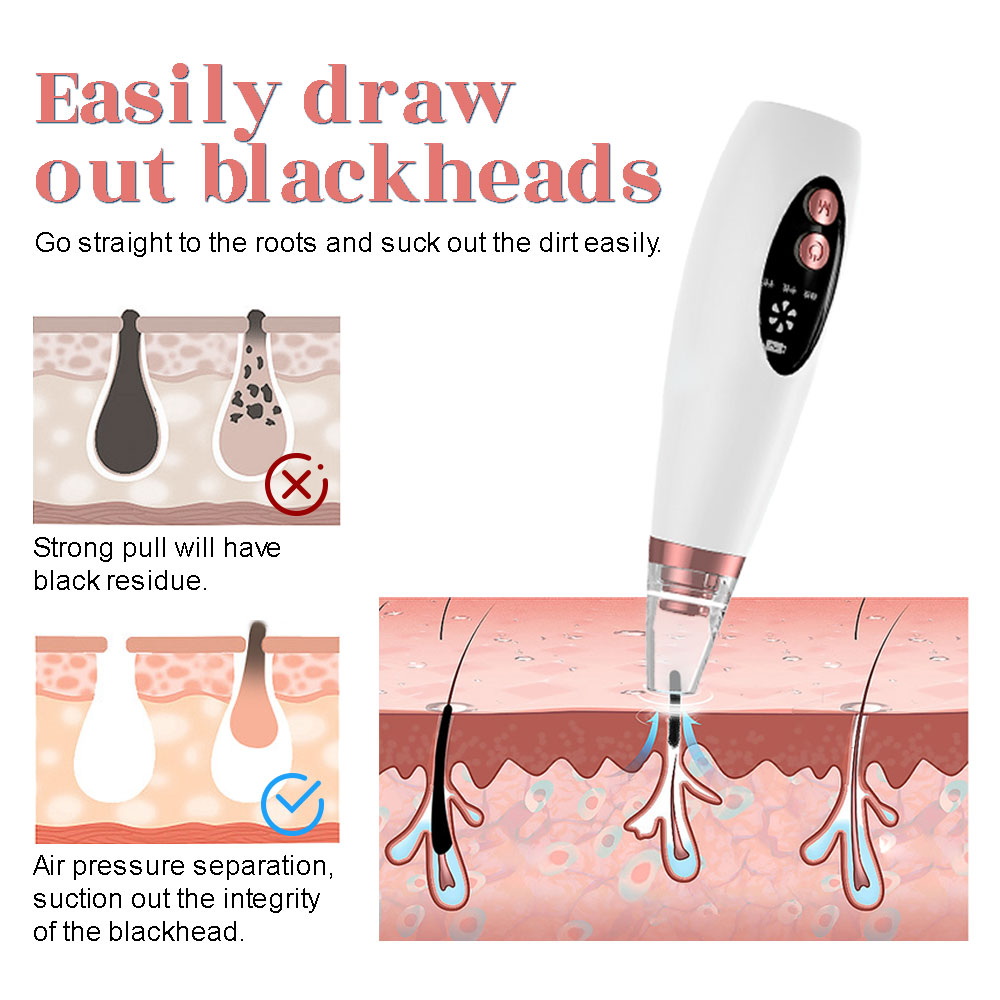 Electric Blackhead Remover Vac - đánh giá và giá Pore Vacuum