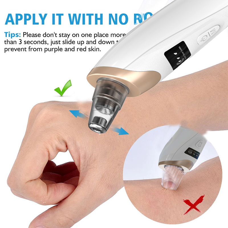 Blackhead Remover Pimples and  - đánh giá và giá Pore Vacuum